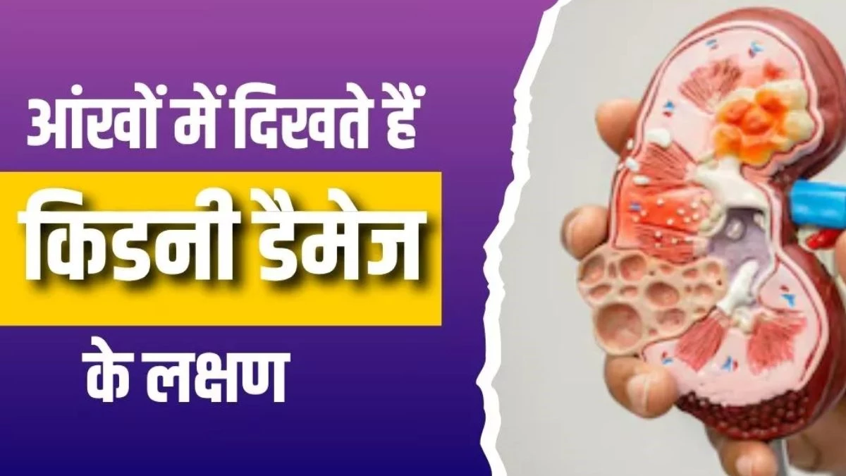 किडनी की समस्या का आंखों पर दिखता है असर, इन लक्षणों को न करें इग्नोर