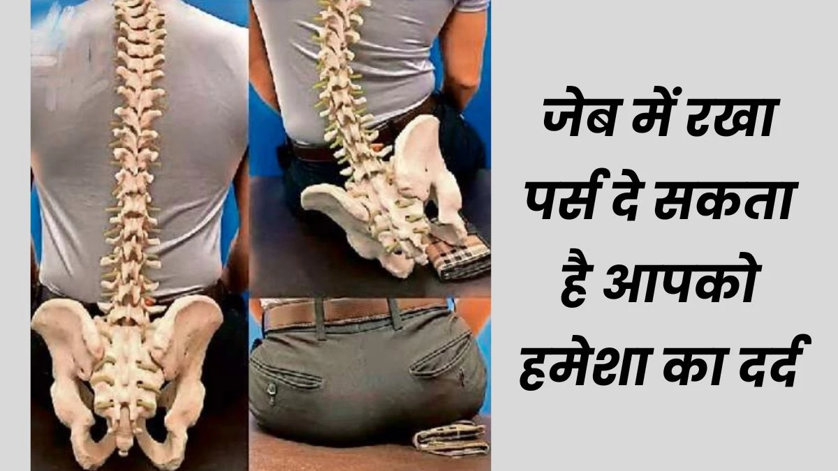 फैट वॉलेट सिंड्रोम : पिछली जेब में मोटा पर्स रखना पड़ सकता है भारी