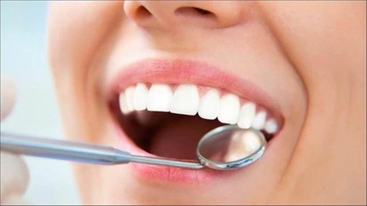 रूट कैनाल ट्रीटमेंट, फिलिंग या कैप लगवाने के लिए फॉलोअप भी इलाज का हिस्सा, टालें नहीं