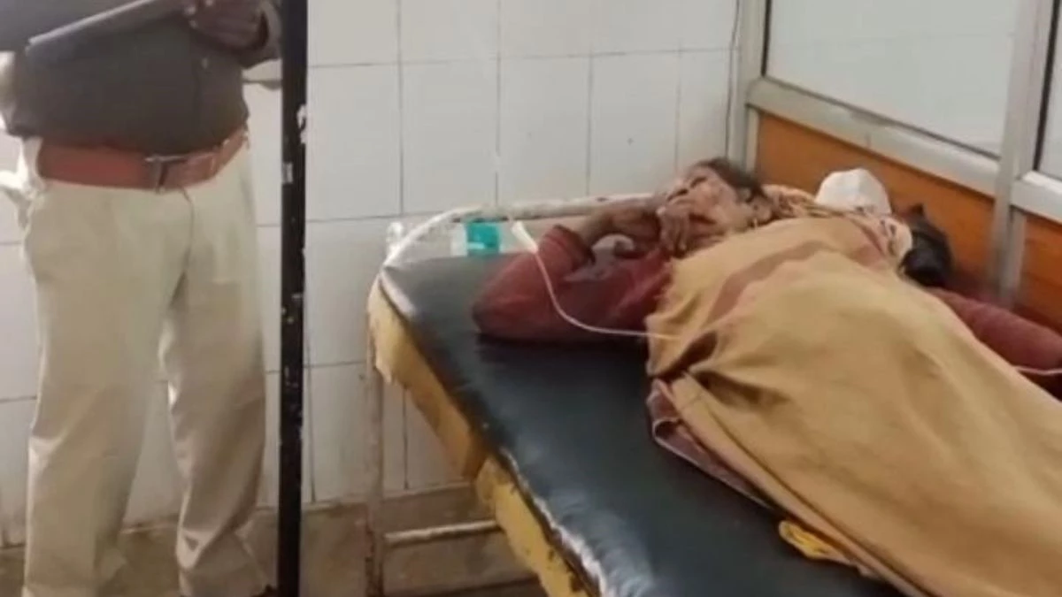 हैवानियत की हदें पार, कटनी में महिला के चेहरे पर पेट्रोल छिड़ककर लगाई आग, गंभीर हालत में अस्पताल में भर्ती