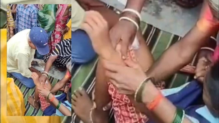 सतना में स्कूल की छत का प्लास्टर पढ़ रहे बच्चों पर गिरा, तीन के सिर फूटे; कई घायल
