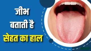 जीभ में जलन को लेकर हो सकती है कई वजह, समय पर जांच जरूरी