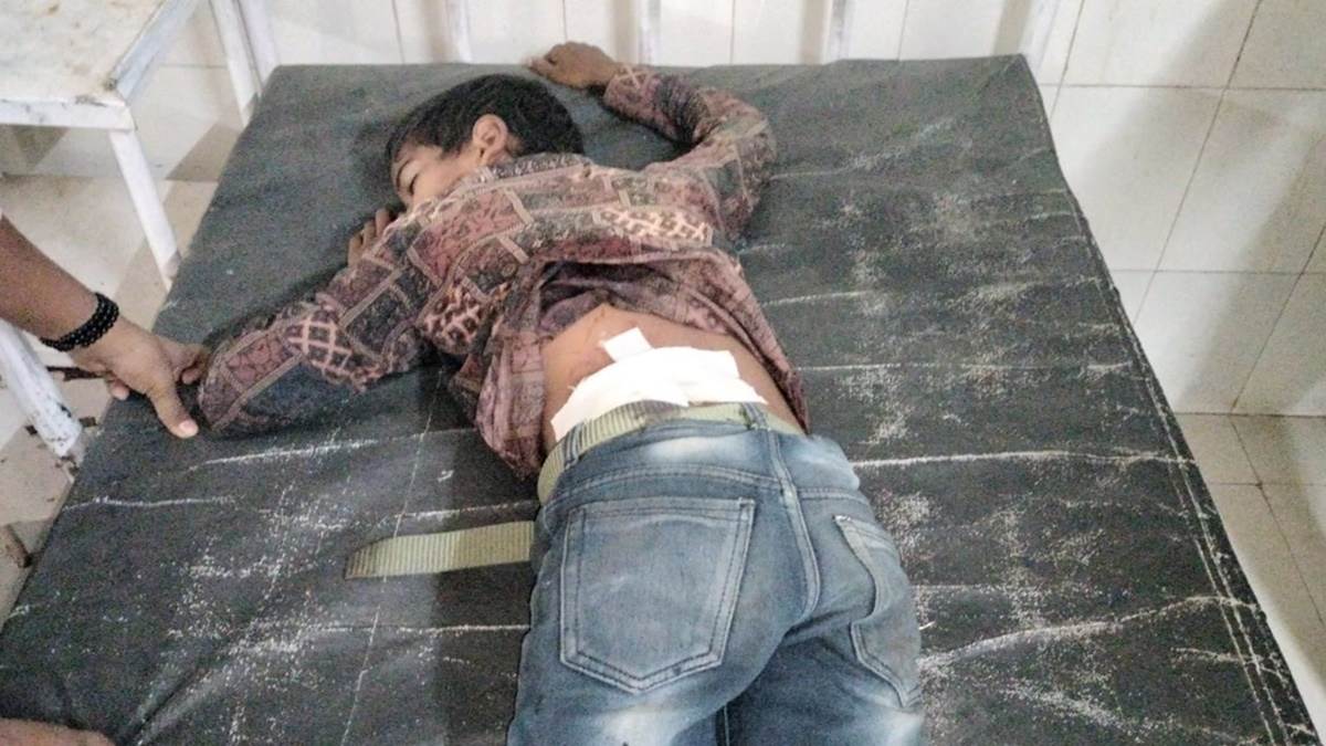Morena Crime News: बाइक से आए बदमाश, पिस्टल से किए फायर, 12 साल का बच्चा हुआ घायल