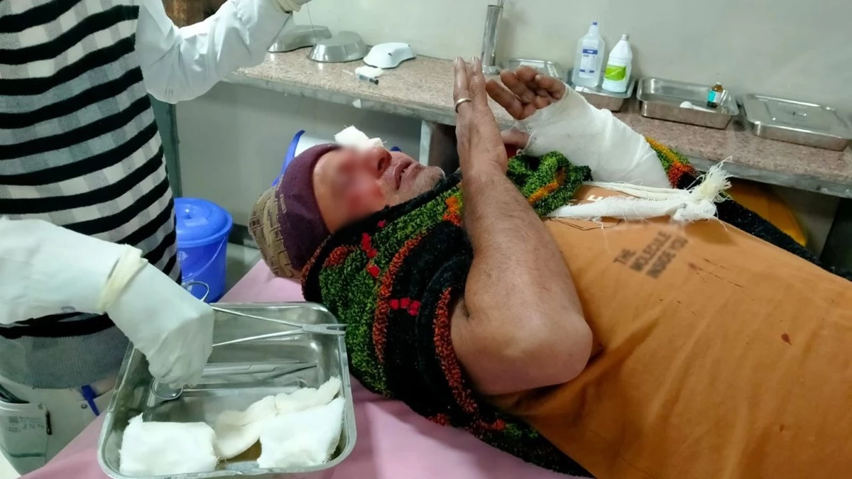 उज्जैन में चाइनीज डोर से कट गई बाइक सवार की नाक, एक महीने में चार लोग हुए घायल