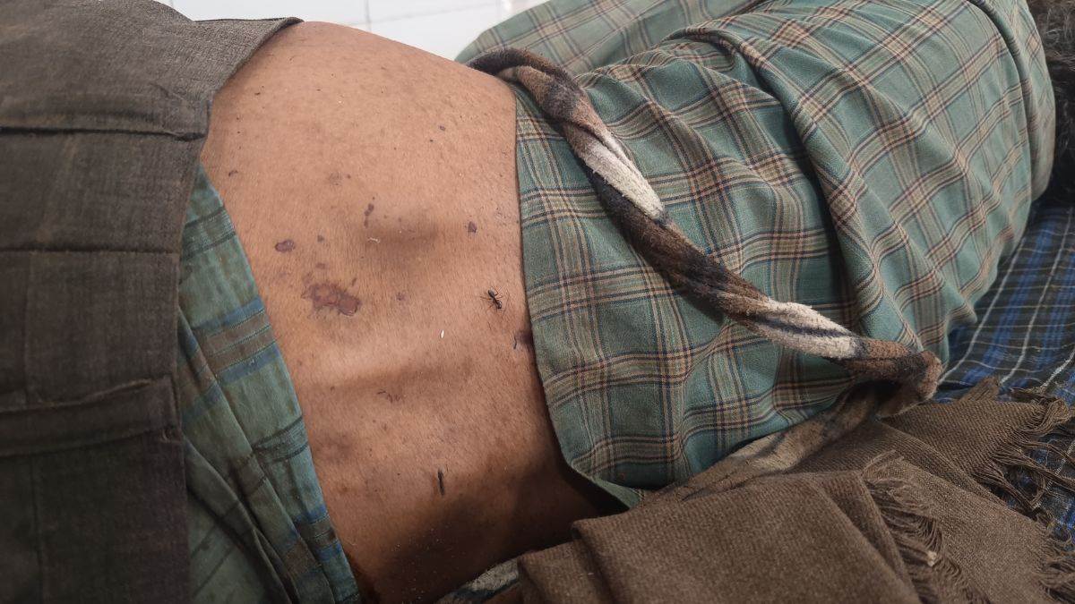 मुरैना में अमानवीयता की हदें पारः तीन दिन तक नहीं मिला इलाज, मौत के बाद शव में लगे चींटे तब चेकअप को आए डॉक्टर