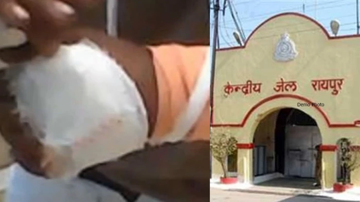 रायपुर सेंट्रल जेल के वायरल वीडियो में वसूली-मारपीट के आरोप, कैदियों ने दिखाए चोट के निशान
