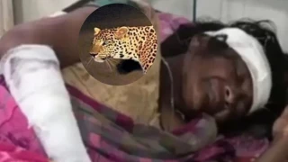 छिंदवाड़ा में मां की जान बचाने तेंदुए से भिड़ा बेटा, 25 मिनट के संघर्ष के बाद चंगुल से छूटे