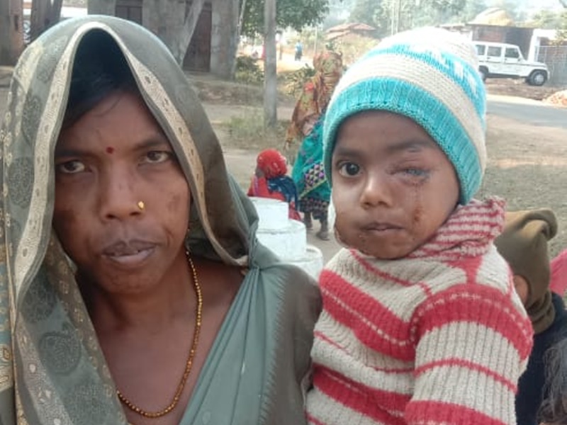 मध्‍य प्रदेश: सीधी में एक किमी तक पीछा कर तेंदुआ के जबड़े से मासूम बेटे को निकालकर ले आई मां