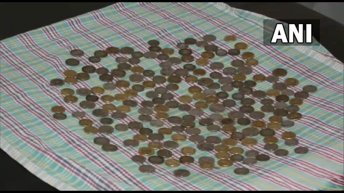 Viral News: चौंकाने वाला मामला, मरीज के पेट में मिले 187 सिक्के, डॉक्टर भी हैरान