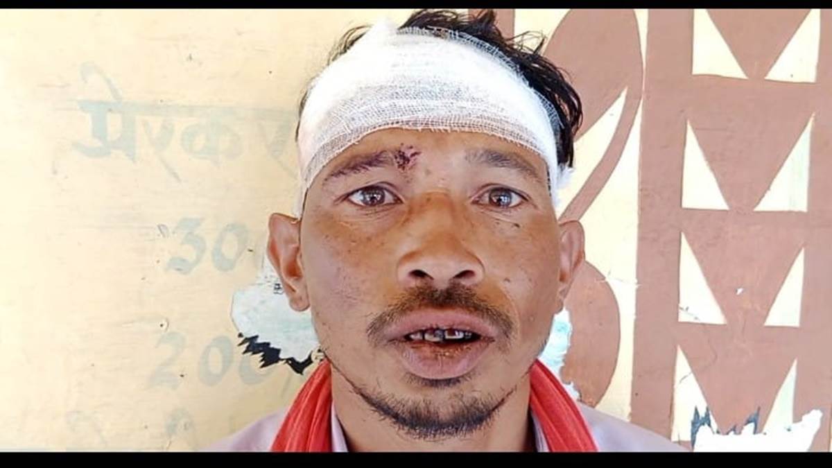 Crime News : बकरियां घर नहीं लौटीं तो पति को पीट-पीट कर किया लहुलुहान, दो महीने पहले भी तोड़ दिया था पति का हाथ
