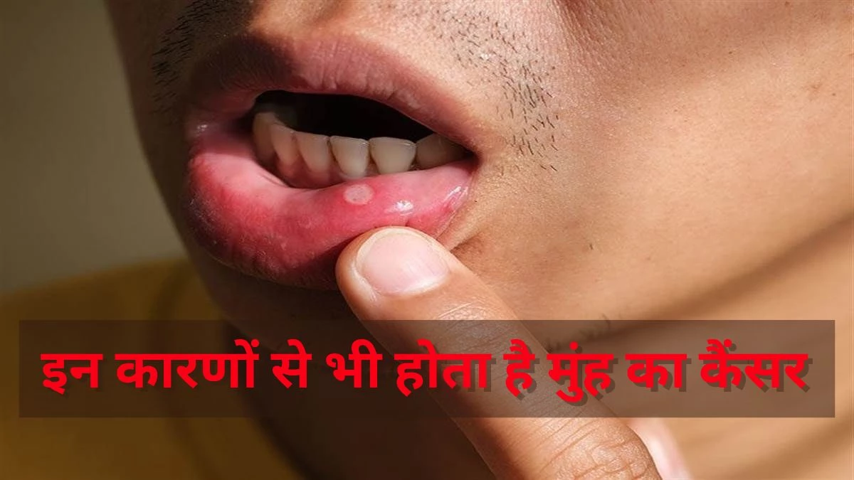 Tobacco prevention day 2025: सिर्फ तंबाकू नहीं तनाव और मुंह की गंदगी भी कैंसर के लिए जिम्मेदार, जानिए क्या कहता है एम्स भोपाल का नया शोध