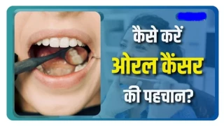 मुंह, गले और फेफड़ों के 80 प्रतिशत कैंसर का कारण तंबाकू, ऐसे करें लक्षणों की पहचान