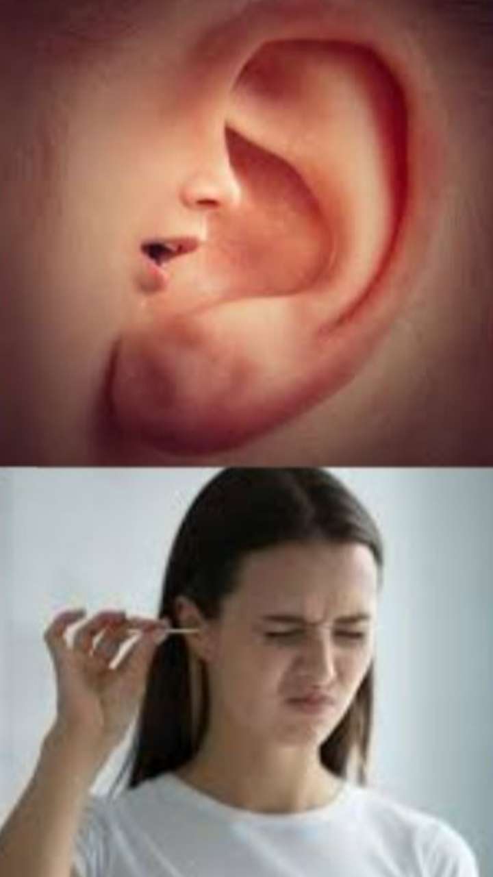कान की समस्या रखे सावधानियां