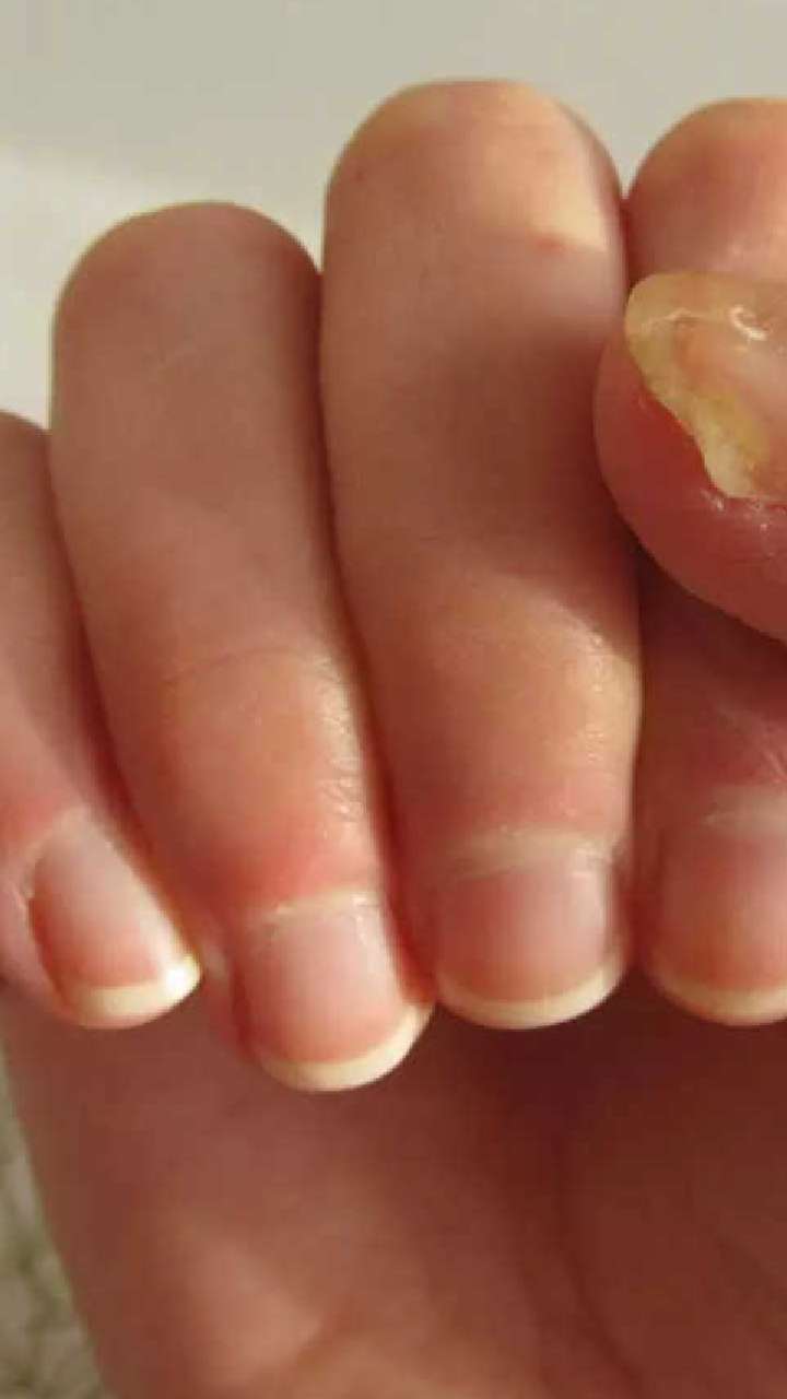 R/docs terry's nails : r/medical